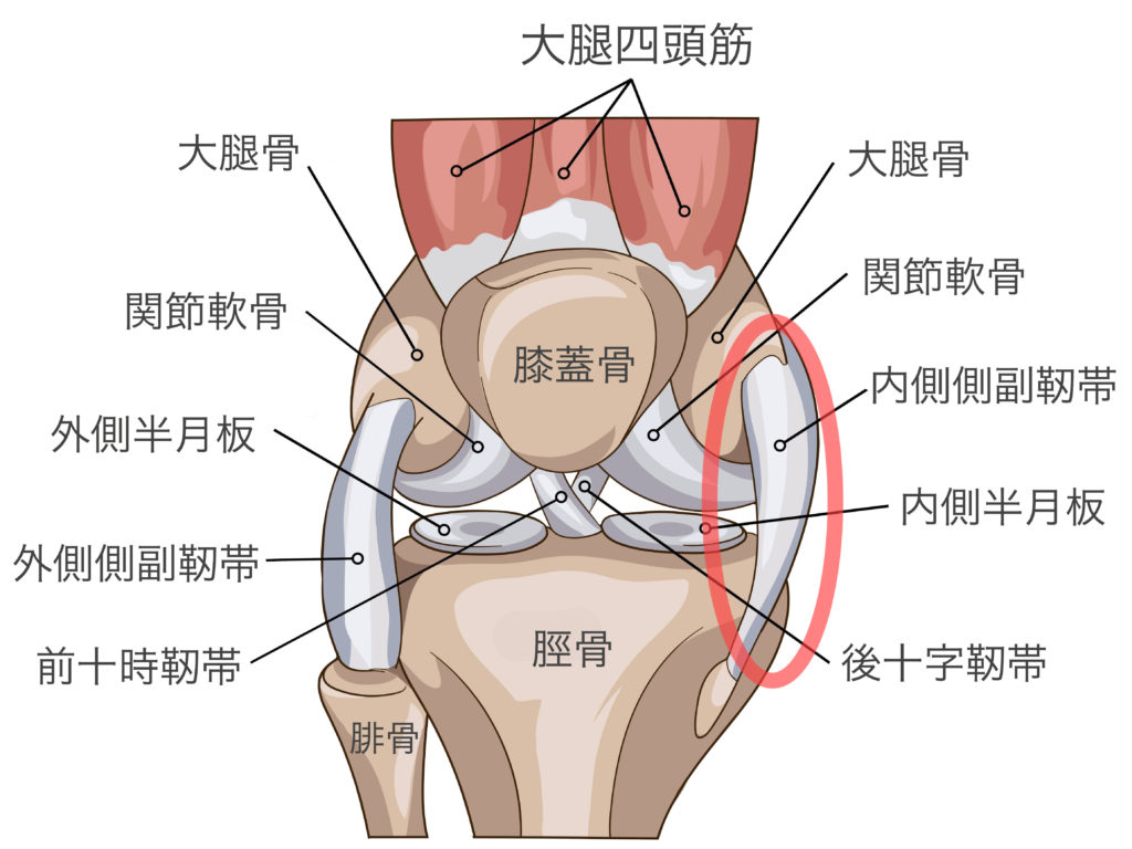 膝内側側副靭帯損傷 Medial Collateral Ligament Tear Physio One